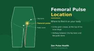 Femoral Pulse Location